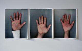 Three photos, in a row, of a single hand with the palm visible.